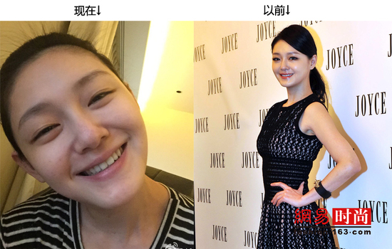 大S幸福生娃后 她曾經(jīng)的美容金句簡直是天雷滾滾