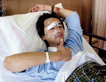 胡歌車禍“毀容”