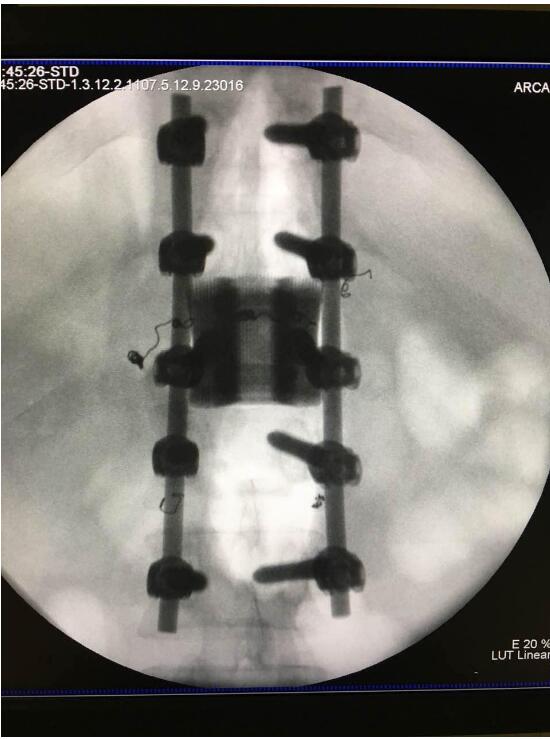 將3D打印引入醫(yī)療，華鈦三維將加快融資腳步-智慧財(cái)經(jīng)網(wǎng)