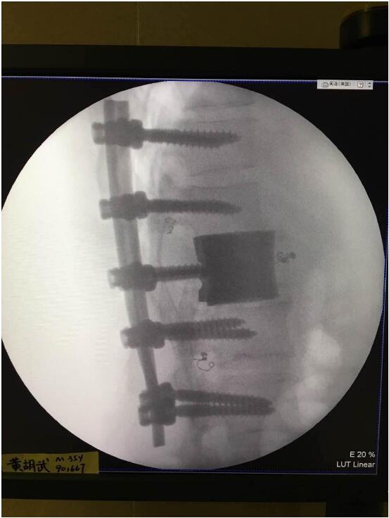將3D打印引入醫(yī)療，華鈦三維將加快融資腳步-智慧財(cái)經(jīng)網(wǎng)