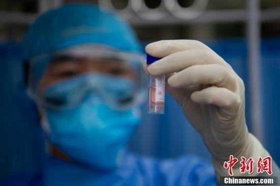 資料圖：3月13日，山西省太原市杏花嶺區(qū)，壩陵橋社區(qū)衛(wèi)生服務(wù)中心的醫(yī)療人員查看返崗復(fù)工人員咽拭子采樣標(biāo)本。a target='_blank' href='http://www.chinanews.com/'中新社/a記者 韋亮 攝