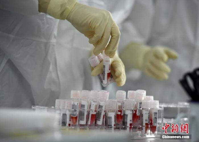 實(shí)驗(yàn)室工作人員整理剛剛送來的經(jīng)預(yù)處理后的樣本。a target='_blank' href='http://www.chinanews.com/'中新社/a記者 侯宇 攝