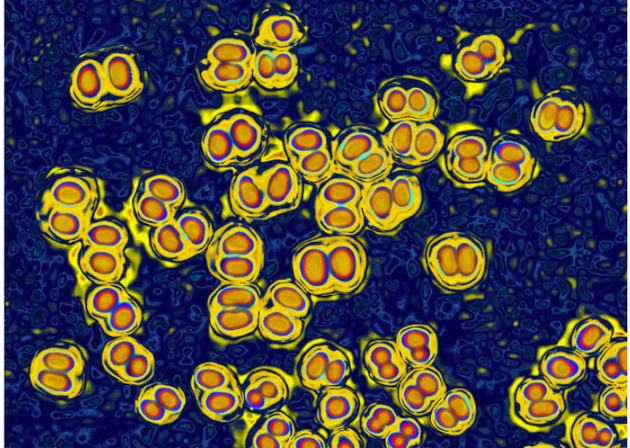 即使接種過疫苗，人體也有可能攜帶某些引起腦膜炎的細(xì)菌