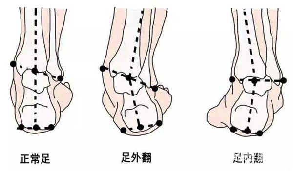 001.jpg?v=1705484742